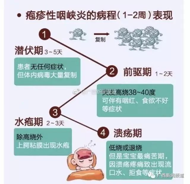 疱疹疫苗最新研究进度-疱疹疫苗研发进展速递